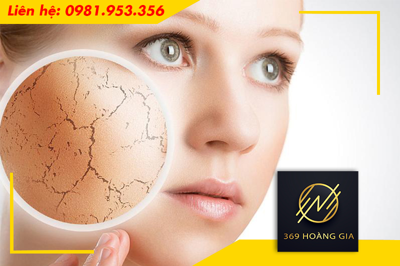 Vì Sao Nằm Điều Hòa Dễ Bị Khô Da